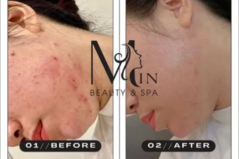 Top 10 Spa làm đẹp uy tín nhất tỉnh Lâm Đồng Đà Lạt – Review & Đặt Chỗ 2026