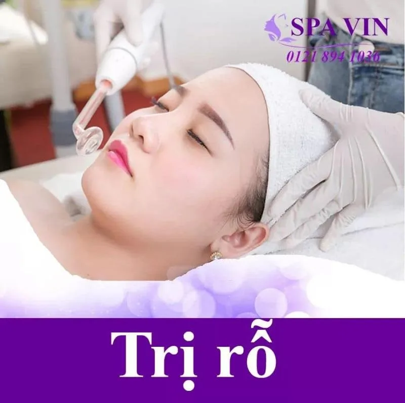 Top 7 Spa trị sẹo rỗ do mụn tốt nhất Đà Lạt – Review & Đặt Chỗ 2026