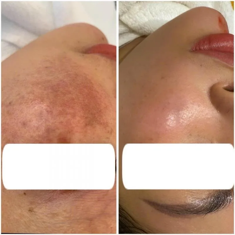 Asana Spa & Clinic – Spa làm đẹp uy tín Đà Lạt chăm sóc toàn diện từ trong ra ngoài tại Đà Lạt