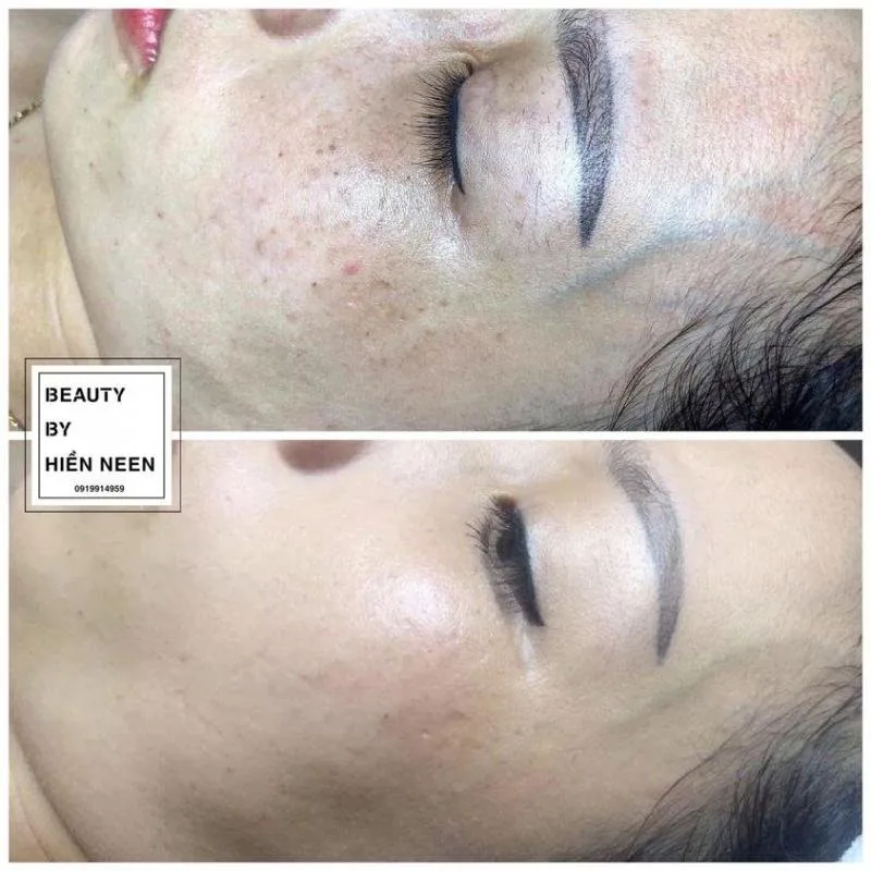 ﻿Hiền Neen Spa tại Đà Lạt