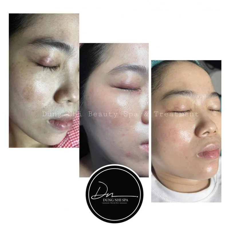 Dung Nhi Beauty Spa & Treatment tại Đà Lạt