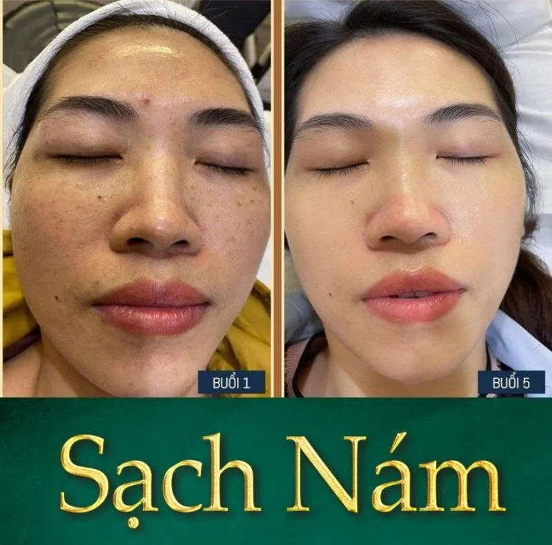 TK Luxury Spa tại Đà Lạt